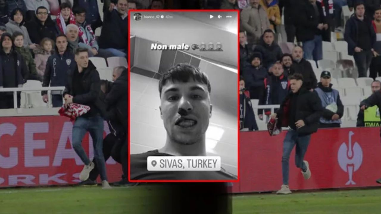 Sivas'ta rezalet: Taraftar Fiorentinalı futbolcunun burnunu kırdı