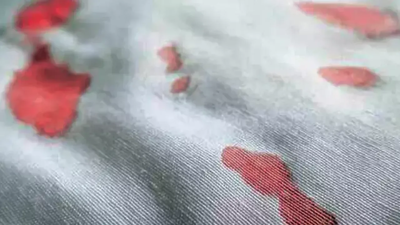 Çıkmayan kan lekesi nasıl çıkar? Kıyafette kurumuş kan lekesi nasıl çıkar?