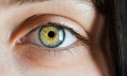 Sarı nokta hastalığı nedir? Tanı ve tedavisi