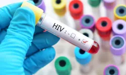 Avrupa HIV testi farkındalık haftası Türkiye'de gerçekleşecek