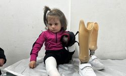 3,5 yaşındaki Tali, protez bacaklarına kavuştu