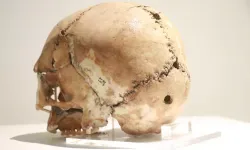 Dünyada bir ilk! İlk beyin ameliyatına ait kafatası Türkiye'de bulundu tam 10 bin 500 yıllık