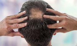 Saç Dökülmesinin Normal Olmadığını Gösteren 7 İşaret: Saçlarınız, Sağlığınızla İlgili Tüyolar Veriyor Olabilir
