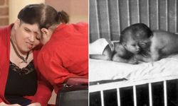 Dünyanın 'En Yaşlı' Yapışık İkizleri Hayatını Kaybetti