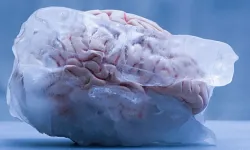 Beyin donması nedir, belirtileri nelerdir? Beyin donması neden olur?