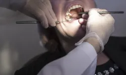 Diş çekiminden sonra kanaması durmayan çocuk öldü!