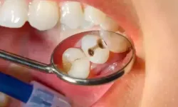 Çocuklarda diş temizliği nasıl yapılmalı? Diş sağlığında altın değerinde tavsiyeler..