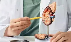 Böbrek Taşı Neden Olur? Belirtileri, Tedavi Yöntemleri ve Korunma Önerileri