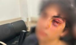15 yaşındaki çocuğu yumruklamışlardı