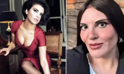Göksel’den estetik iddialarına net yanıt