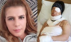 Eski sevgiliden uykuda kezzap vahşeti: 'Anlattıkları kan dondurdu'