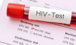 HIV’e karşı umut veren gelişme