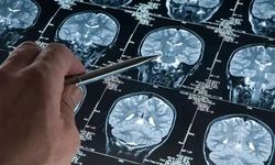 Alzheimer araştırmalarında umut ışığı