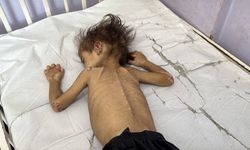 Felaket derinleşiyor: Gazze’de açlıktan ölenlerin sayısı 425’e çıktı