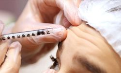 15 yaşa kadar düştü: Dermatoloji Derneği’nden “botoks” uyarısı