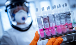 DSÖ harekete geçti: Afrika’da ortaya çıkan yeni virüs hızla yayılıyor