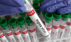 Ölümcül mpox alarmı: Clade 1b varyantı Avrupa’ya yayıldı, uzmanlardan ‘aşı kıtlığı’ uyarısı