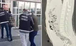 Tesadüfen yakalandılar... Midelerinden 1.5 kilo uyuşturucu çıktı