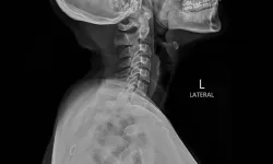 Sağlıkta Yapay Zeka Kaosu: Röntgenler Doktorları Yanıltıyor