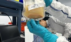 İlk "uydu karaciğer" hastaya nakledildi!