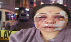 Eşini darbeden polise tahliye