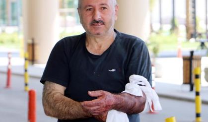 İzmir'de 365 acemi kasap hastanelere başvurdu