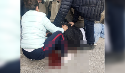 Feci kaza: Yüzünden kopan parçayı hastaneye götürdüler