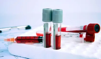 Ruh sağlığında biyolojik devrim: Depresyonun izleri artık kanda sürülebilir