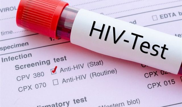 İzmir’de 13 yaşındaki çocuk AIDS’ten öldü