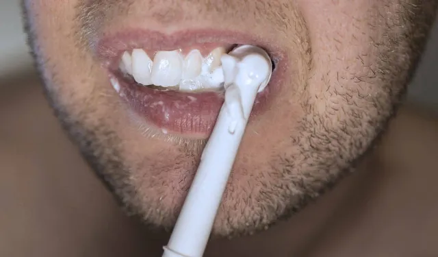 İnternetten alınan diş beyazlatma ürünlerine dikkat!