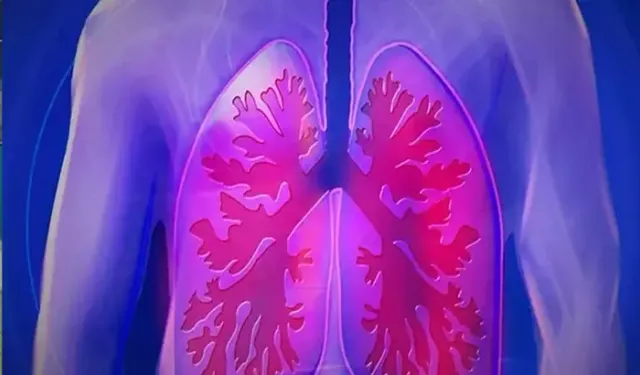 Akciğer kanserinin karanlık yüzü: Her 5 kanser ölümünden biri bu hastalıktan kaynaklanıyor