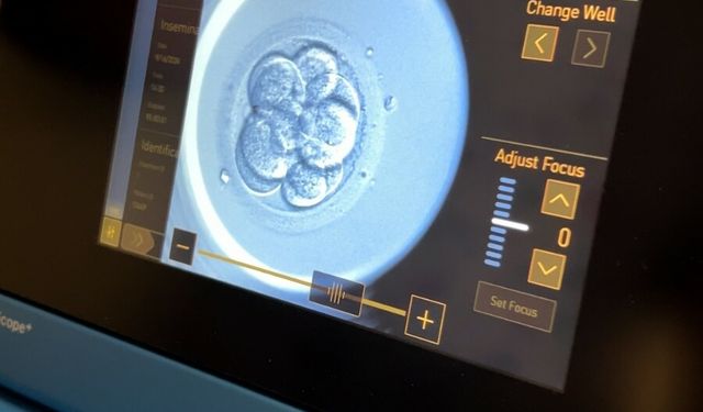 Yapay zeka desteğiyle 'Mucize bebek' umudu