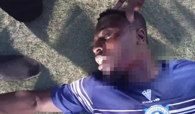 Fanatik taraftar gol atan futbolcuyu boğanzından bıçakladı