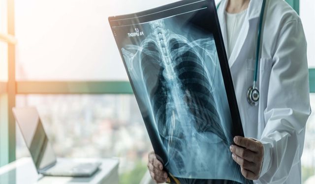 Uzmanlardan kış uyarısı: Hafife almayın, zatürreye dönüşebilir