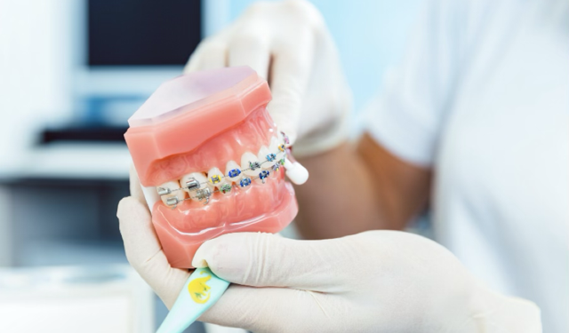 Yeni Yılda Diş Teli Yaptırmayı Düşünenler Dikkat: 2026 Fiyatları Nasıl Belirleniyor?