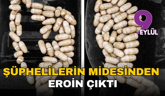 İzmir'de Akılalmaz Kaçakçılık Yöntemi: Şüphelilerin Midesinden 1 Kilonun Üzerinde Eroin Çıktı