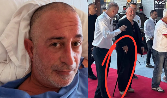 Cem Yılmaz bastonla görüntülendi