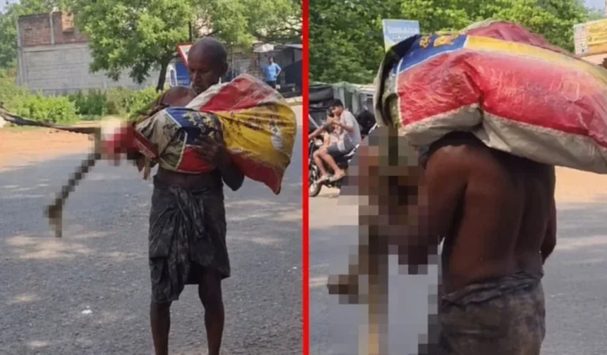 Kardeşinin iskeletiyle bankaya para çekmeye gitti