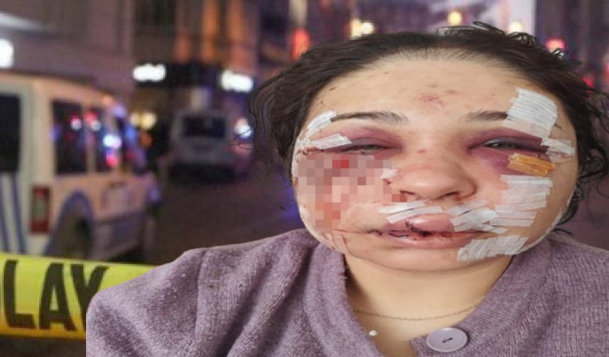 Eşini darbeden polise tahliye