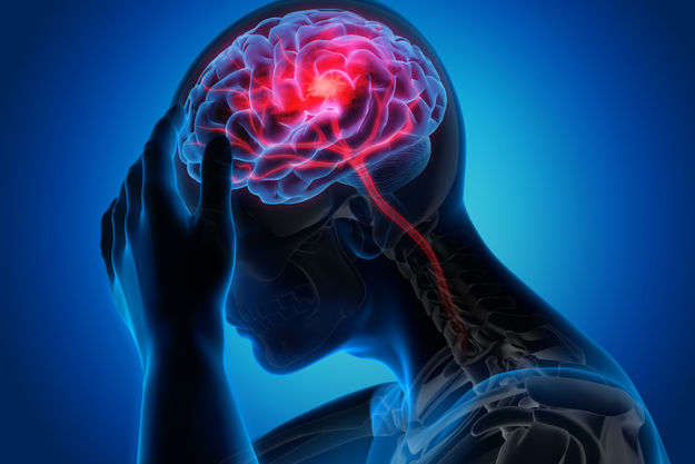 Migren hastalığının psikolojik ve zihinsel belirtileri nelerdir? 