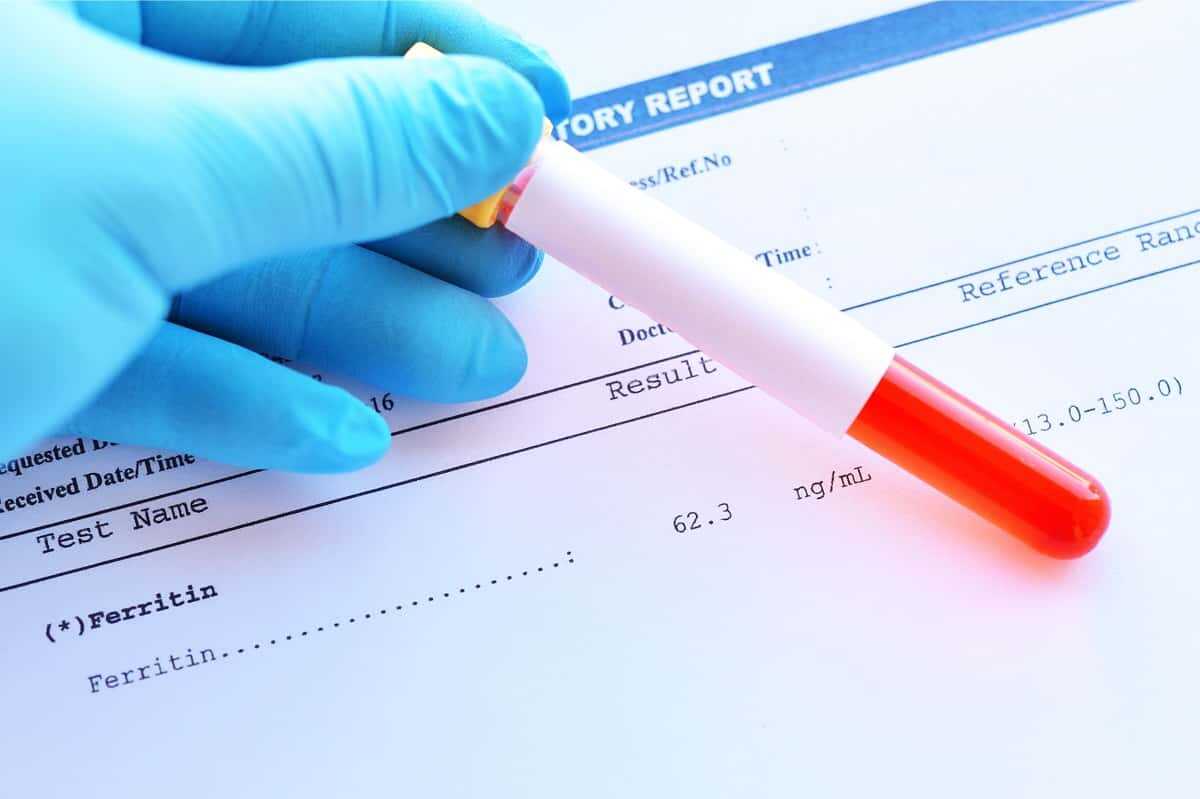 Ferritin Düşüklüğü Nedir?