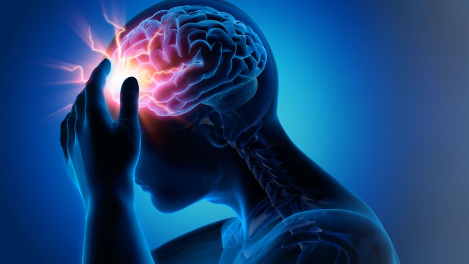 Epilepsi nedir?