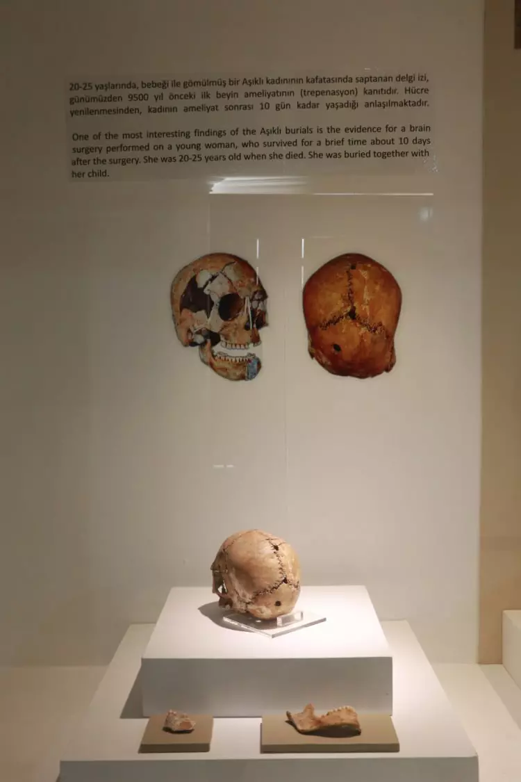 Dünyada bir ilk! İlk beyin ameliyatına ait kafatası Türkiye'de bulundu tam 10 bin 500 yıllık-2