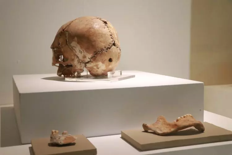 Dünyada bir ilk! İlk beyin ameliyatına ait kafatası Türkiye'de bulundu tam 10 bin 500 yıllık-3