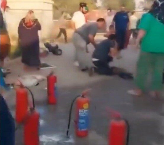 Yanginda Agir Yaralanan Cocuk Hayatini Kaybetti C81518454458