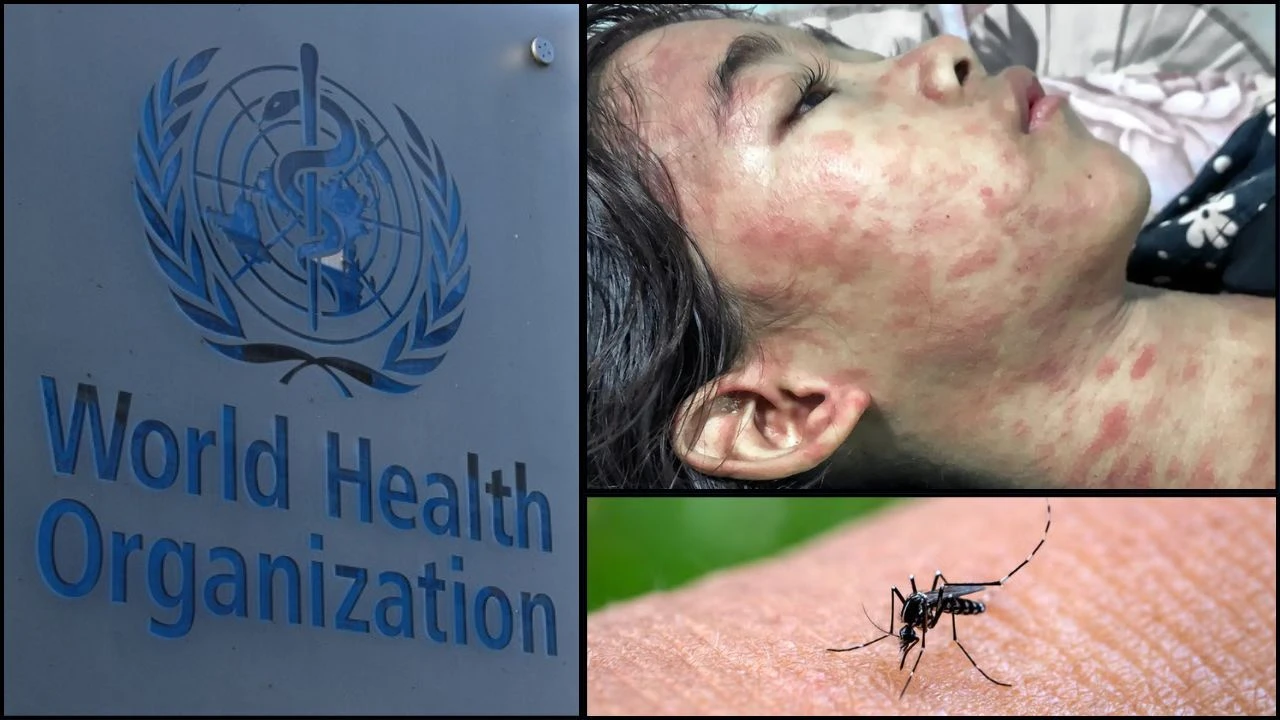 Chikungunya Virus Nedir Bulasici Mi Olumcul Mu Dunya Saglik Orgutu Uyardi 17533454694430