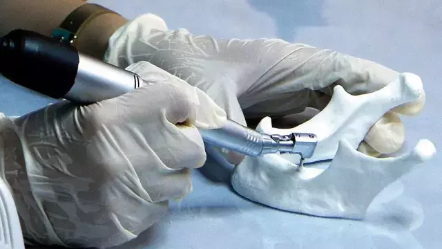 Milyonlari Ilgilendiren Teklif Meclis E Sunuldu 19327973 6244 M