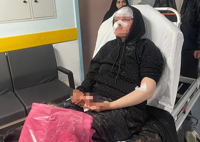 0X0 Gaziantepte Sokak Ortasinda Koca Vahseti Olduresiye Darp Edildi 1769612762510