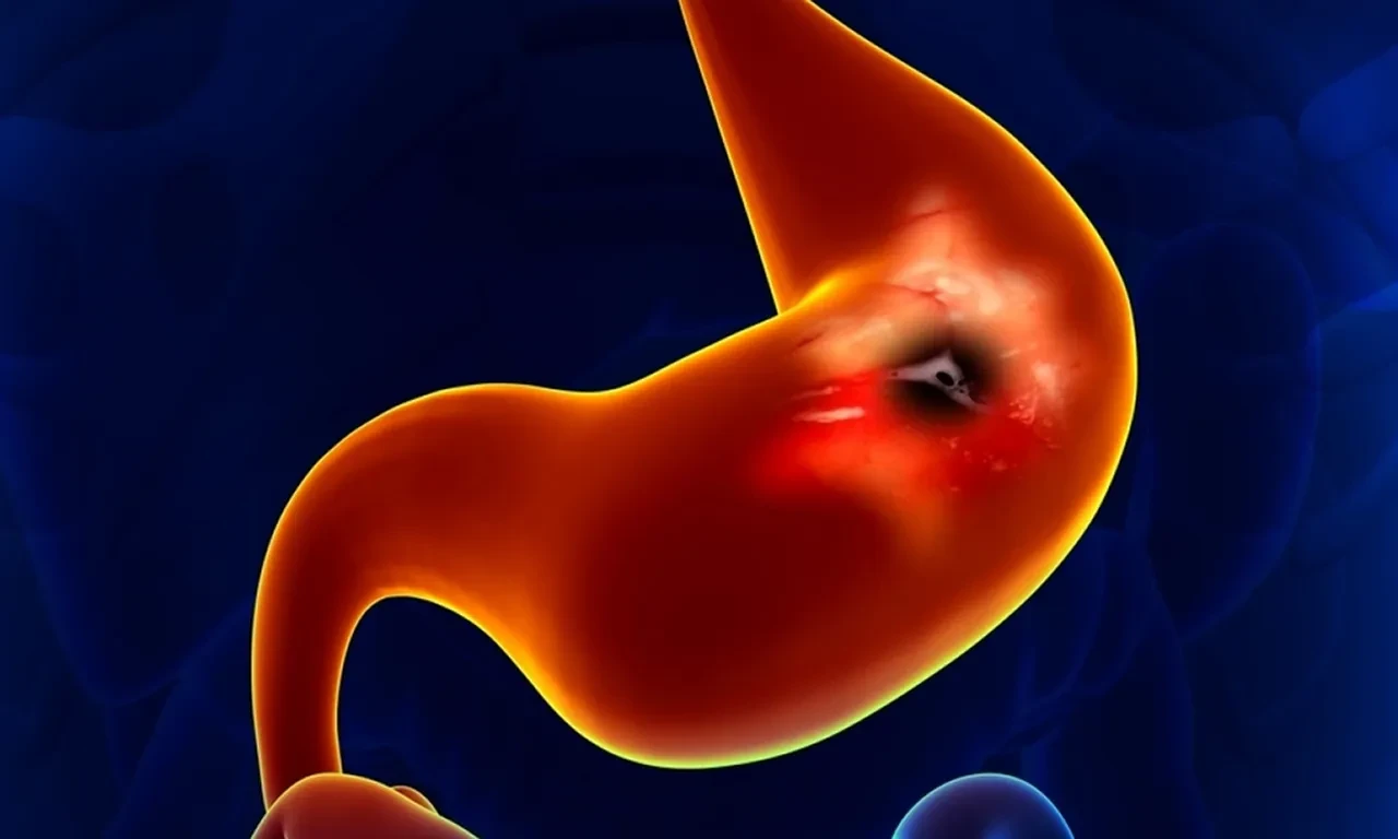 Cabuk Doyanlar Dikkat Yillar Icinde Sessizce Buyuyor Risk Ortaya Cikiyor 3276557 202601150923 2