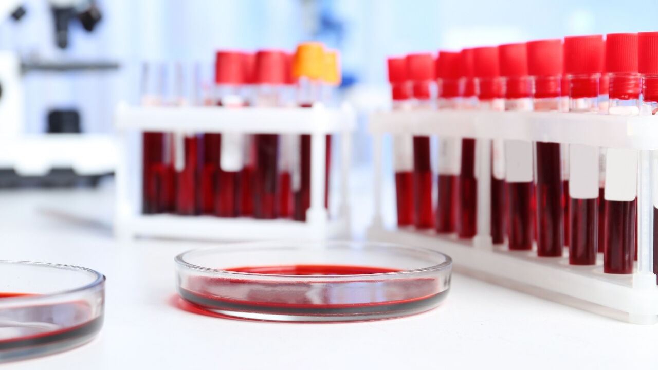 Haytata Kalama Süresi